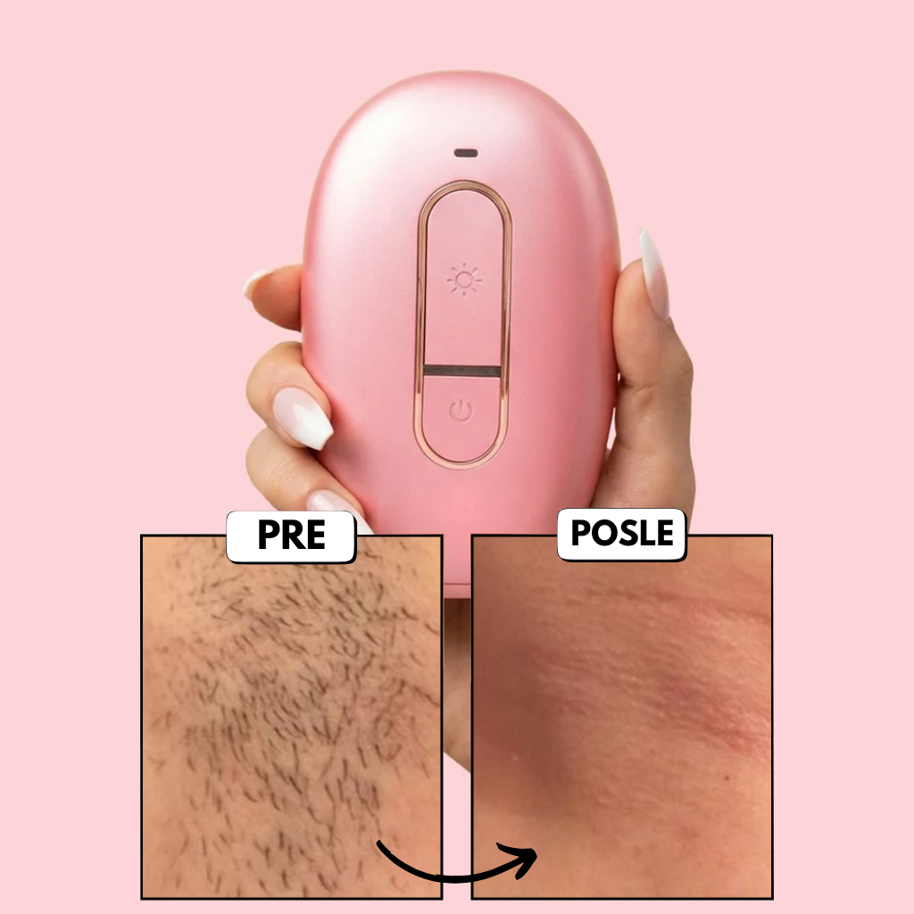 Laserski Epilator Verzija 2.0 - Nova Generacija